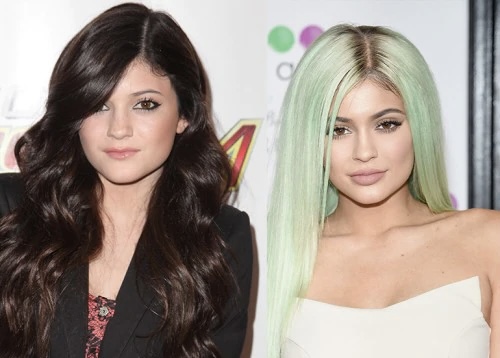 Ku buron dëshira për ndërhyrje? Tek VIP-at që po transformohen keq e më keq