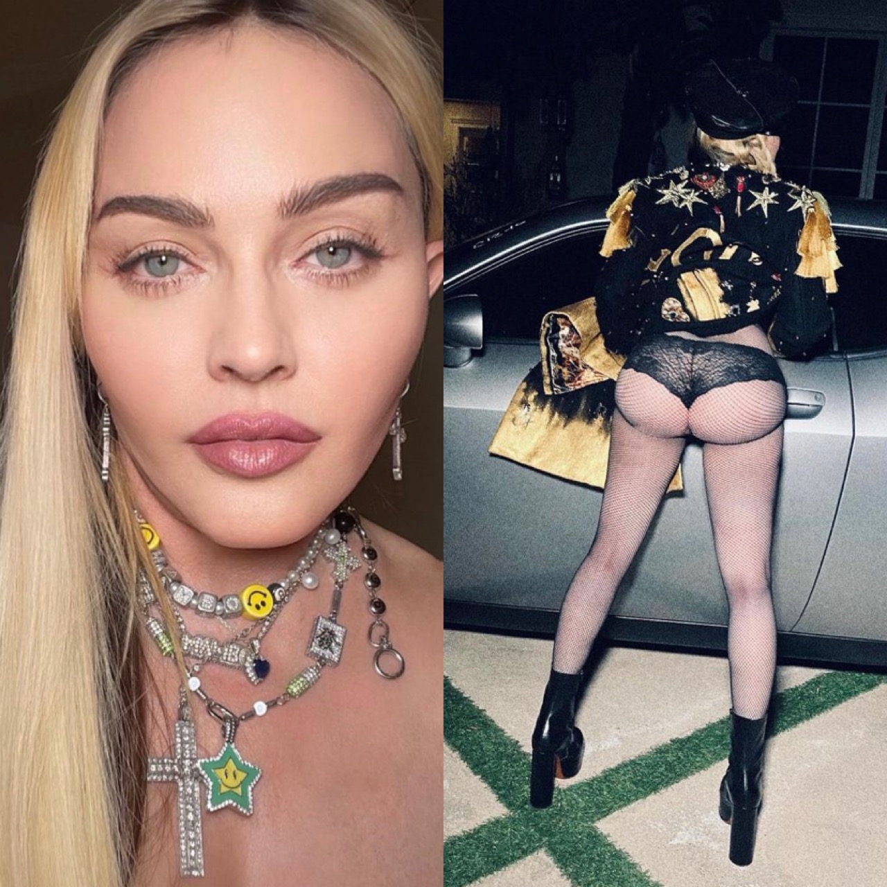 Madonna-s nuk i mjafton kirurgjia, nuk hedh asnjë foto pa filtra