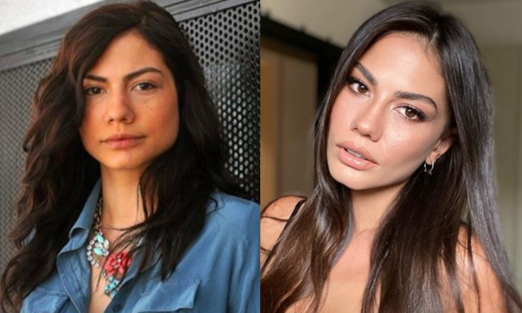 Demet Ozdemir u përgjigjet akuzave për operacione plastike: Ku ta gjej kohën?