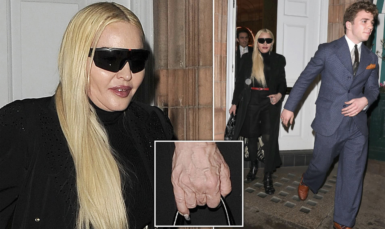 Ja ku vjen dhe një foto pa filtra e Madonna-s, shumë larg nga imazhi i ‘Instagram-it’