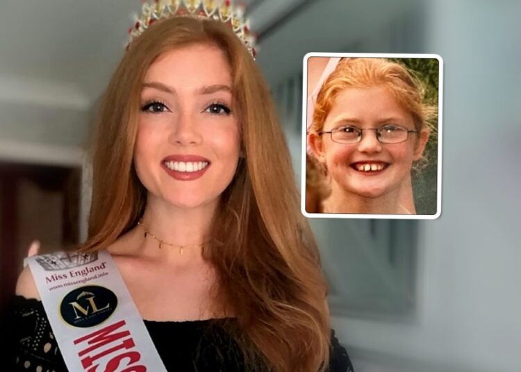 “Më kanë goditur, pështyrë”, rrëfimi i vajzës që fitoi Miss Anglia 2022!