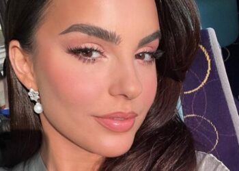 Këtë tipar në fytyrë dikur Armina e kishte kompleks, sot ia kanë zili