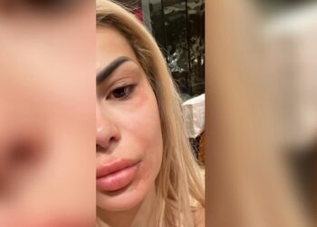 Pas një lodhjeje të gjatë në punë, Luana përfundoi kështu!