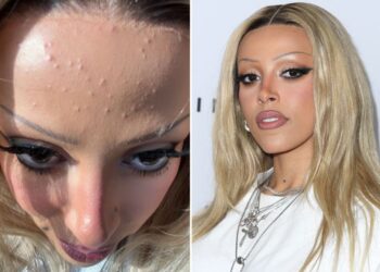 Në foton pa filtra të Doja Cat, mund ta gjejmë veten të gjithë!