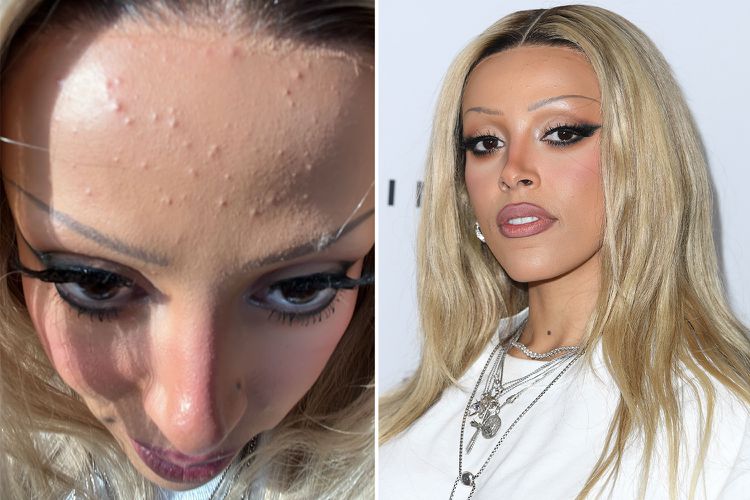 Në foton pa filtra të Doja Cat, mund ta gjejmë veten të gjithë!