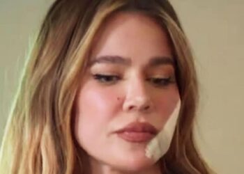 U diagnostikua me melanoma, Khloe Kardashian tregon foto pas operacionit