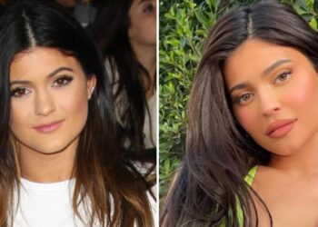 Kylie Jenner thotë se nuk ka bërë aq ndërhyrje në fytyrë sa mendojnë njerëzit: Vetëm buzët!