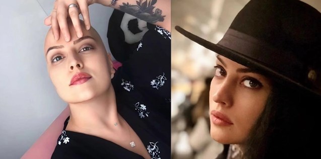 “Do ta mund këtë sëmundje për vajzën time”, aktorja turke në luftë me kancerin