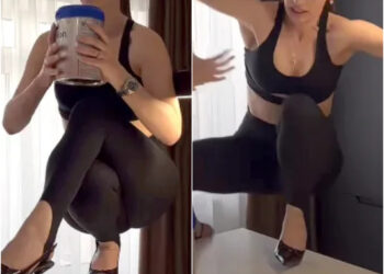 Trend i rrezikshëm? Influencerja dëmtohet rëndë pas sfidës së Nicki Minaj