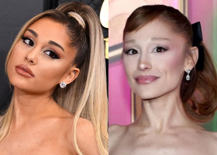 Cila është sëmundja nga e cila dyshohet se vuan Ariana Grande dhe pse mjekët e quajnë rrezik serioz?