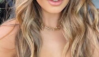 Modelja e njohur shkrin filler-in si dhuratë Krishtlindjesh për prindërit! 