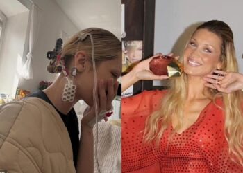 Më duhej të thosha ‘jo’ për të shpëtuar veten”, Bella Hadid flet hapur për 14 vite betejë me sëmundjen Lyme